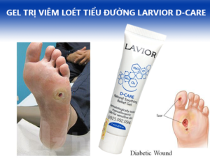 Gel điều trị viêm loét tiểu đường Lavior D-care 2