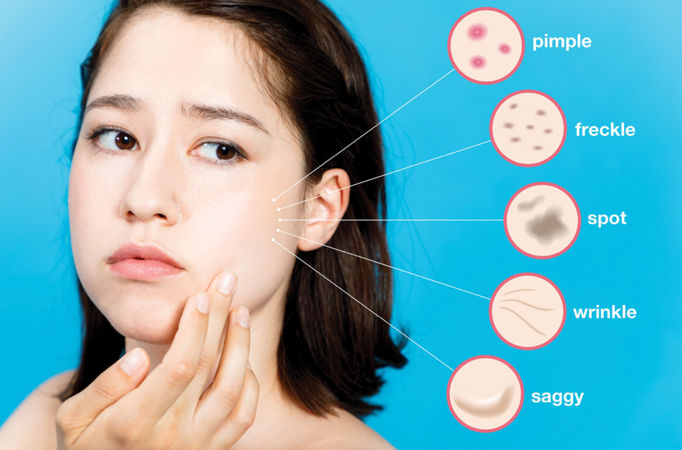 gel trị sẹo Scarguard