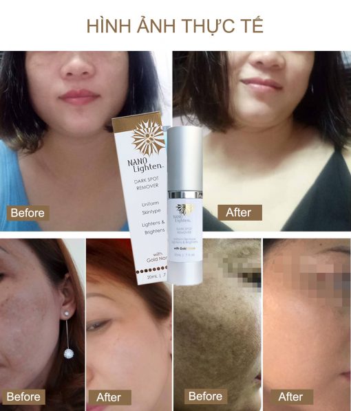 Serum đặc trị nám Nano Lighten Dark Spot Remover 3