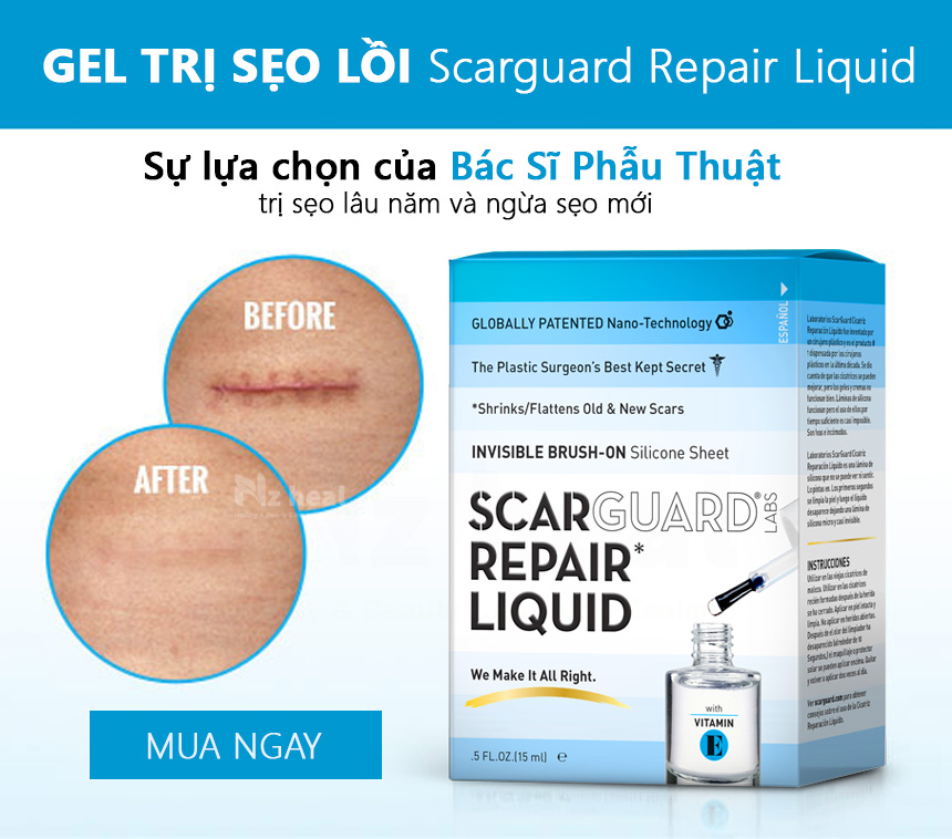 Scarguard Repair Liquid (Scarguard MD) - bước tiến lớn trong trị sẹo lồi