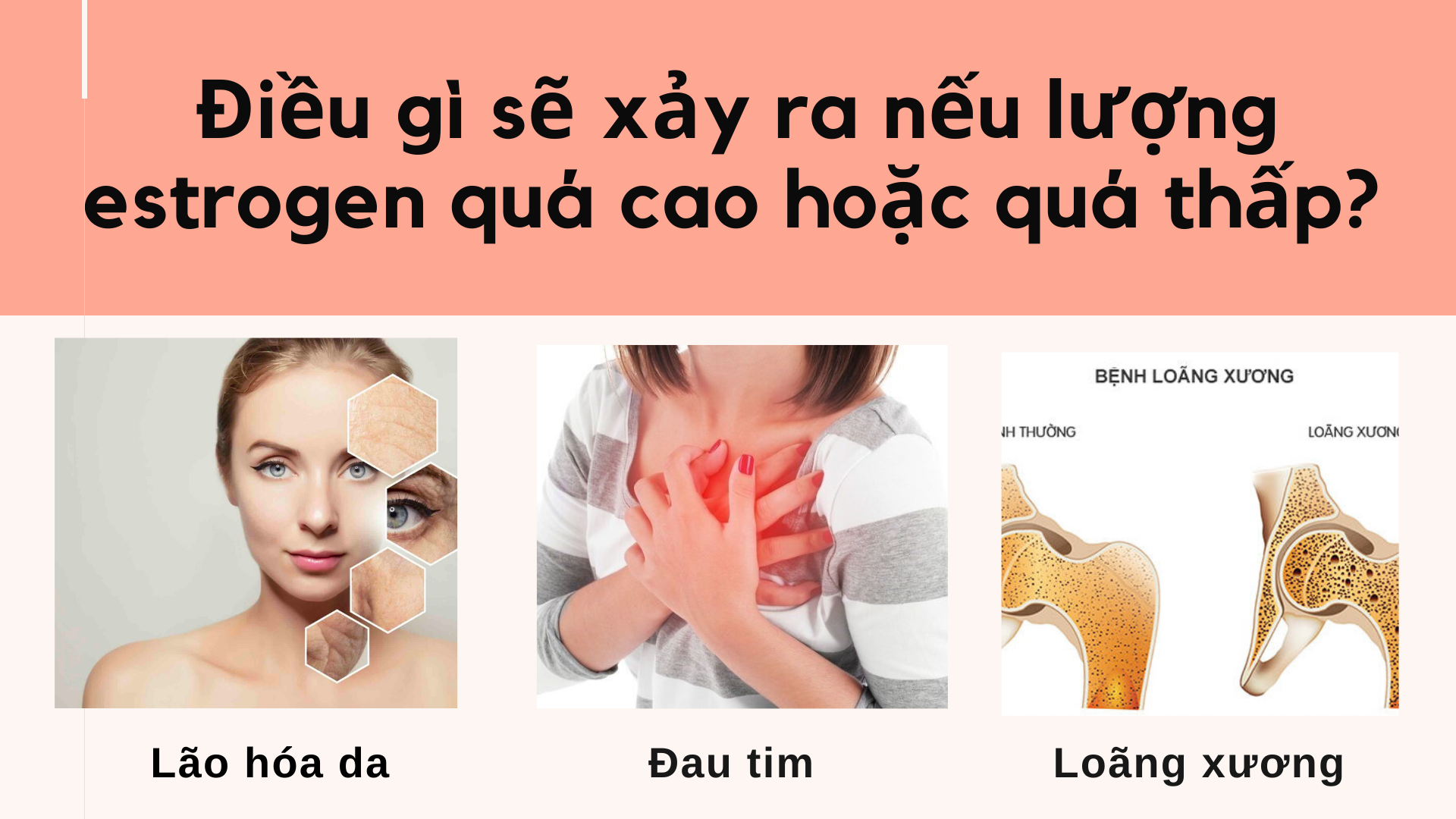 4. Các Vấn Đề Sức Khỏe Liên Quan Đến Estrogen Cao