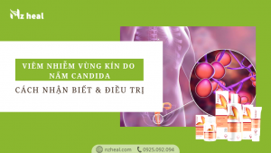 Bộ Kolorex: chống nấm Candida