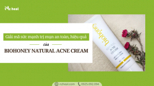Giải mã sức mạnh trị mụn an toàn, hiệu quả của Manuka Biohoney Natural Acne Cream
