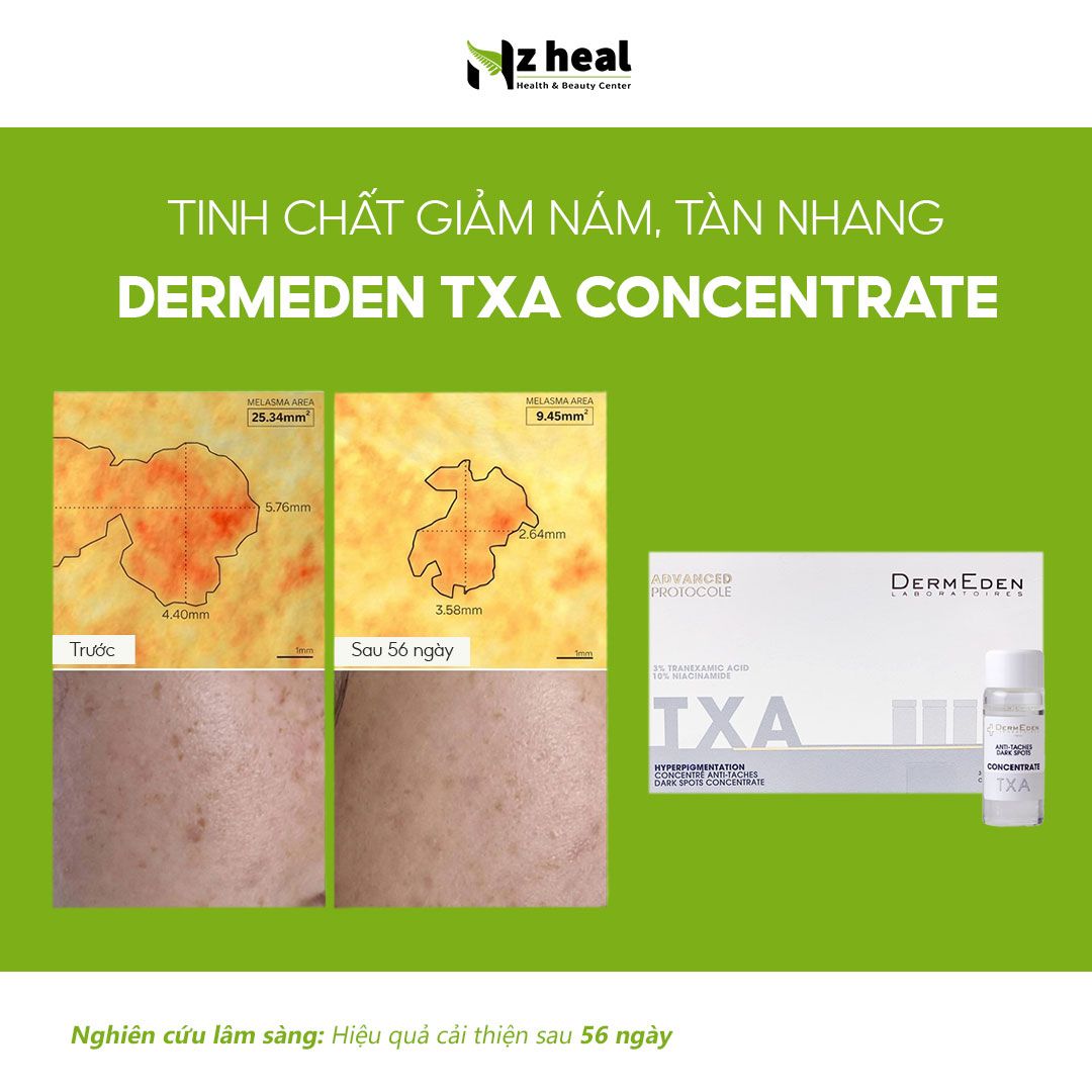 tinh-chat-tri-nam-giam-tan-nhang-dermeden-concentrate-anti-taches-dark-spots Tinh chất trị nám, giảm tàn nhang DermEden Concentrate Anti-Taches Dark Spots TXA (10ml x 3)