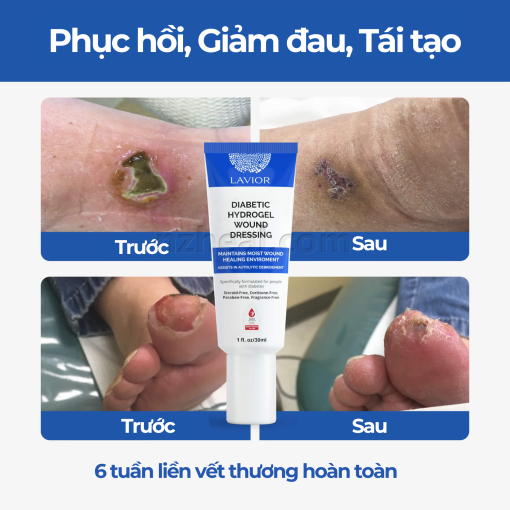 Gel băng vết thương hở LAVIOR Diabetic Hydrogel Wound Dressing (30ml)