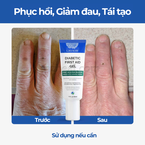 Gel sơ cứu vết thương tiểu đường LAVIOR Diabetic First Aid Gel (20ml)