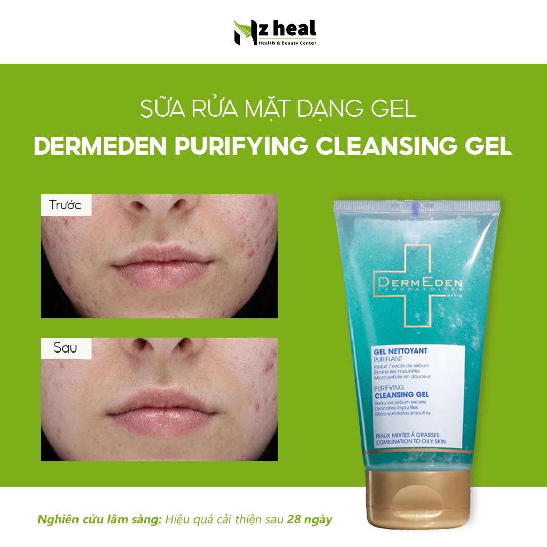 Sữa rửa mặt dạng gel Dermeden Purifying Cleansing Gel (150ml) – Da hỗn hợp/ Da dầu