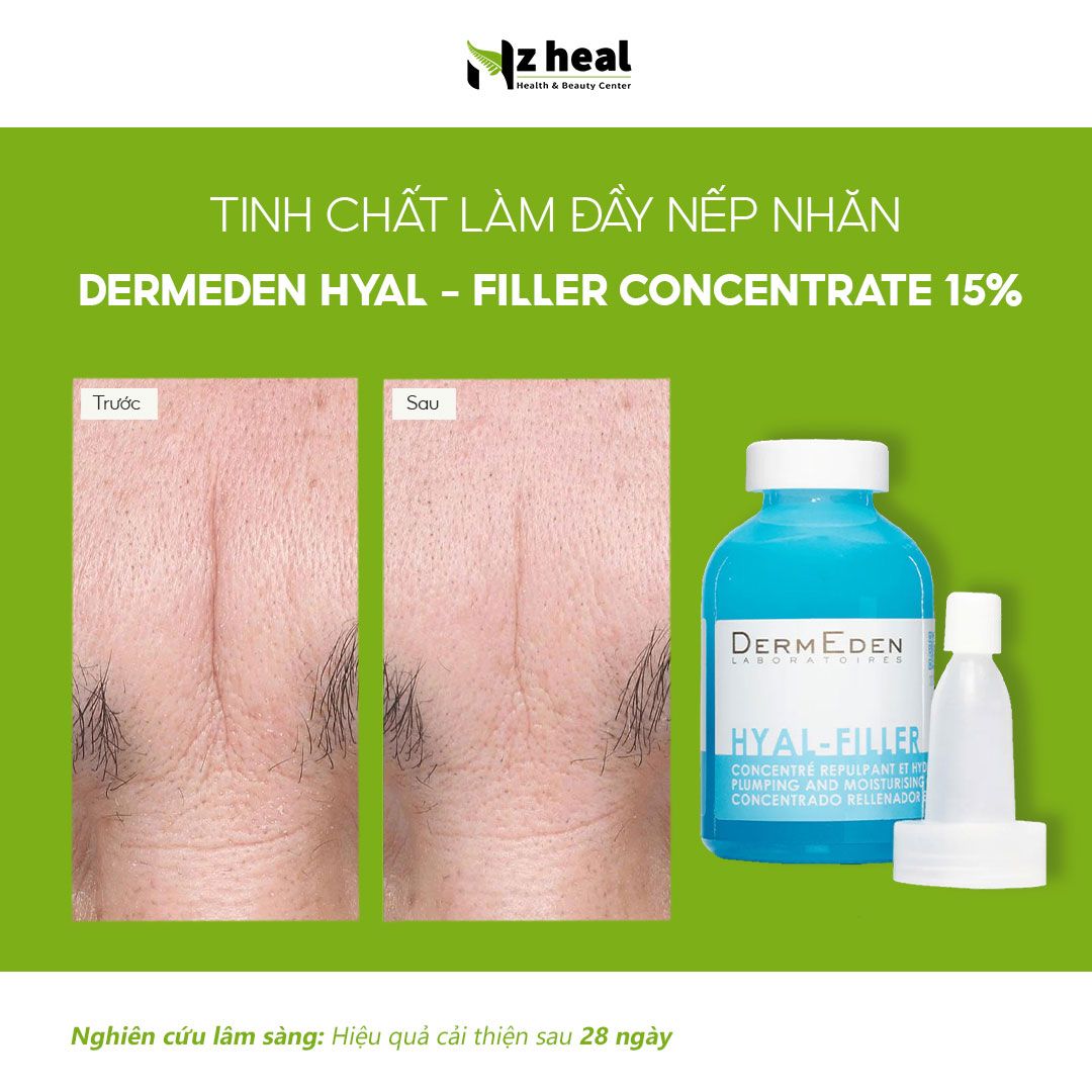 Tinh chất làm đầy nếp nhăn, căng mịn da Hyal-Filler DermEden Plumping & Moisturising Concentrate 15% (30ml)