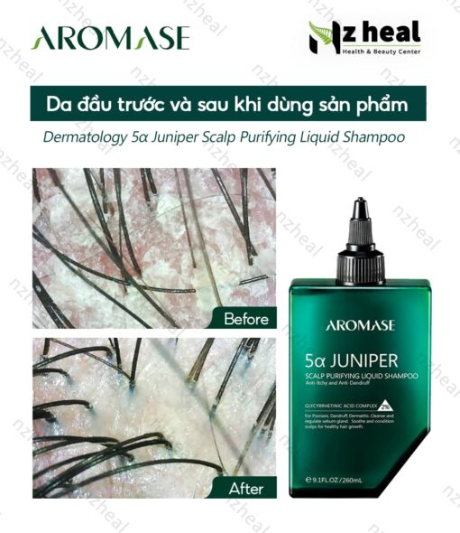 Dầu gội làm sạch sâu da đầu dạng lỏng Aromase 5α Juniper Scalp Purifying Liquid Shampoo 80ml 8