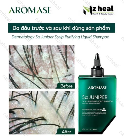 Dầu gội làm sạch sâu da đầu dạng lỏng Aromase 5α Juniper Scalp Purifying Liquid Shampoo 80ml 8