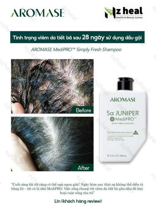 Dầu gội ngăn gàu, giảm viêm da đầu chuyên sâu Aromase 5α Juniper MediPRO Simply Fresh Shampoo 80ml 1-1