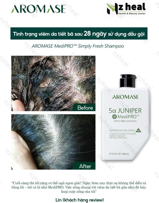 Dầu gội ngăn gàu, giảm viêm da đầu chuyên sâu Aromase 5α Juniper MediPRO Simply Fresh Shampoo 80ml 1-1