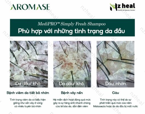 Dầu gội ngăn gàu, giảm viêm da đầu chuyên sâu Aromase 5α Juniper MediPRO Simply Fresh Shampoo 80ml 3-1