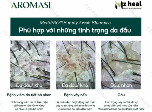 Dầu gội ngăn gàu, giảm viêm da đầu chuyên sâu Aromase 5α Juniper MediPRO Simply Fresh Shampoo 80ml 3-1