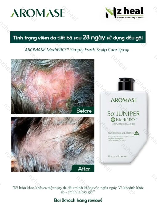 Dầu gội ngăn gàu, giảm viêm da đầu chuyên sâu Aromase 5α Juniper MediPRO Simply Fresh Shampoo 80ml 4-1