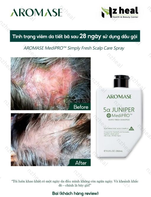 Dầu gội ngăn gàu, giảm viêm da đầu chuyên sâu Aromase 5α Juniper MediPRO Simply Fresh Shampoo 80ml 4-1
