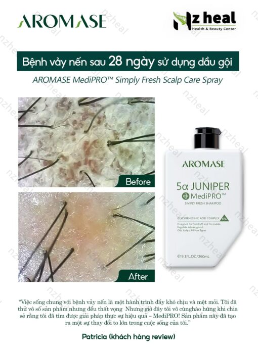 Dầu gội ngăn gàu, giảm viêm da đầu chuyên sâu Aromase 5α Juniper MediPRO Simply Fresh Shampoo 80ml 7