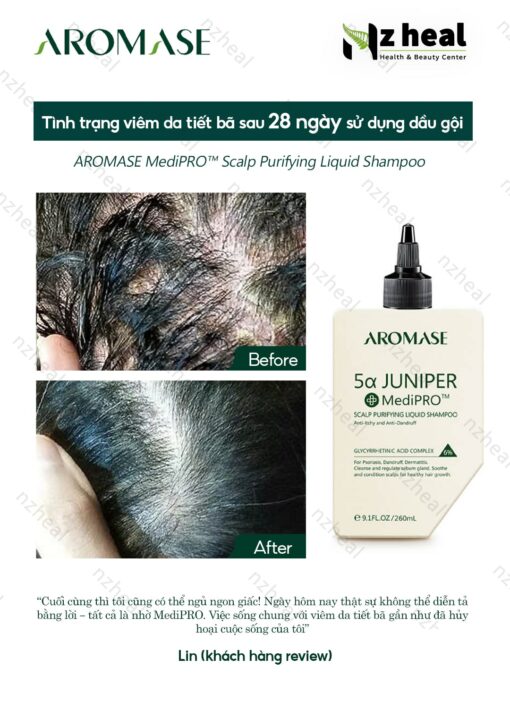 Dầu gội sạch da đầu chuyên sâu dạng lỏng Aromase 5α Juniper MediPRO Scalp Purifying Liquid Shampoo 80ml 4
