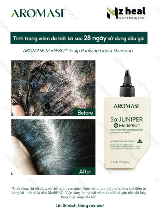 Dầu gội sạch da đầu chuyên sâu dạng lỏng Aromase 5α Juniper MediPRO Scalp Purifying Liquid Shampoo 80ml 4