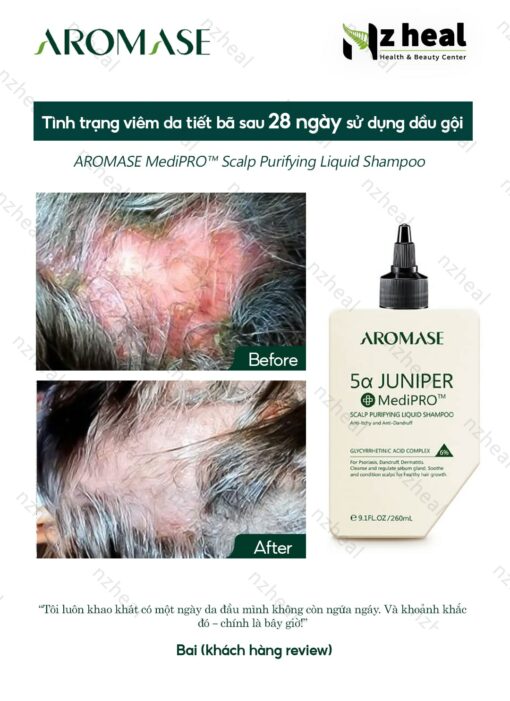 Dầu gội sạch da đầu chuyên sâu dạng lỏng Aromase 5α Juniper MediPRO Scalp Purifying Liquid Shampoo 80ml 6