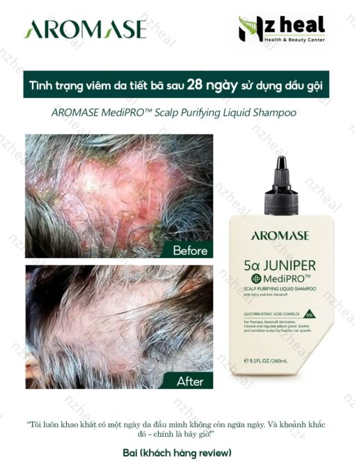 Dầu gội sạch da đầu chuyên sâu dạng lỏng Aromase 5α Juniper MediPRO Scalp Purifying Liquid Shampoo 80ml 6