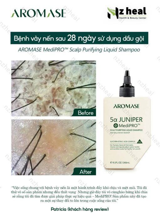 Dầu gội sạch da đầu chuyên sâu dạng lỏng Aromase 5α Juniper MediPRO Scalp Purifying Liquid Shampoo 80ml 7