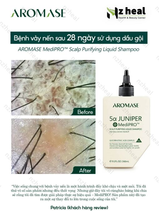 Dầu gội sạch da đầu chuyên sâu dạng lỏng Aromase 5α Juniper MediPRO Scalp Purifying Liquid Shampoo 80ml 7