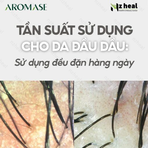 Dầu gội trị gàu và giảm nhờn da đầu Aromase Oily Scalp Balancing Shampoo 90ml 1