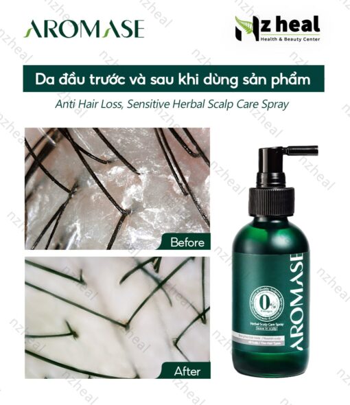 Xịt dưỡng tóc và da đầu Aromase Herbal Scalp Care Spray 40ml (da đầu khô) 1-1