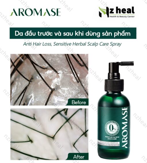Xịt dưỡng tóc và da đầu Aromase Herbal Scalp Care Spray 40ml (da đầu khô) 1-1
