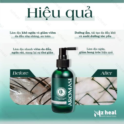Xịt dưỡng tóc và da đầu Aromase Herbal Scalp Care Spray 40ml (da đầu khô) 2