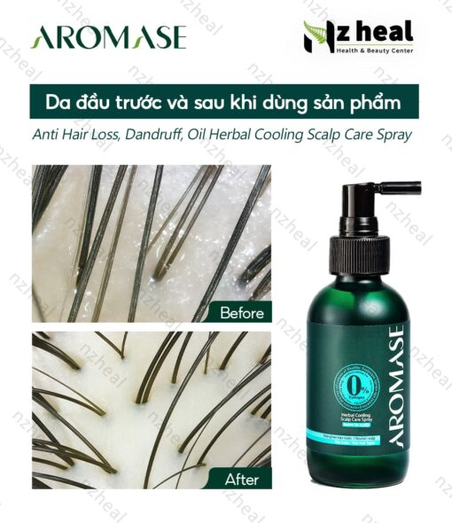 Xịt dưỡng tóc và làm dịu viêm da đầu Aromase Herbal Cooling Scalp Care Spray 40ml (da đầu dầu) 3-1