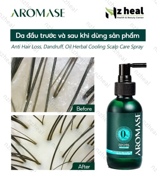 Xịt dưỡng tóc và làm dịu viêm da đầu Aromase Herbal Cooling Scalp Care Spray 40ml (da đầu dầu) 3-1