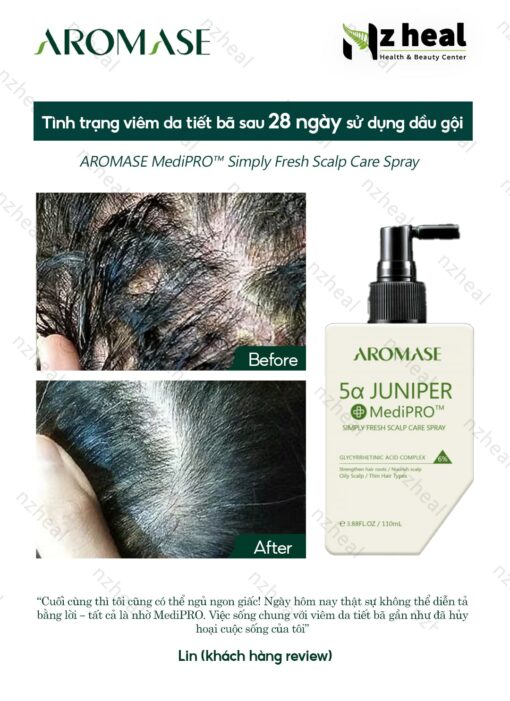 Xịt dưỡng và giảm viêm da đầu chuyên sâu Aromase 5α Juniper MediPRO Simply Fresh Spray 110ml 1-1