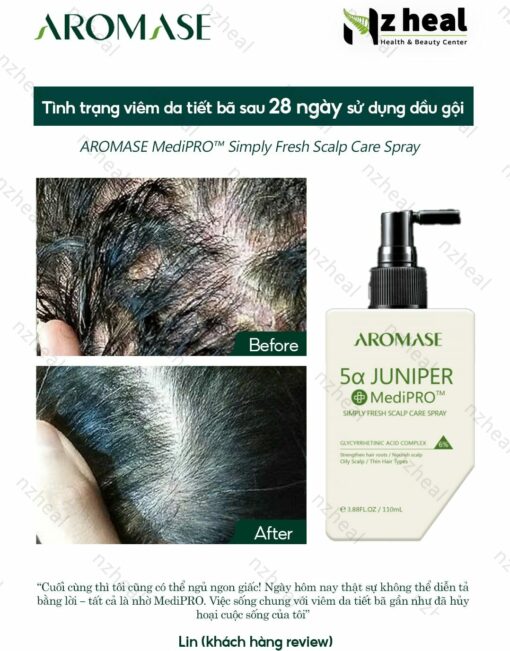 Xịt dưỡng và giảm viêm da đầu chuyên sâu Aromase 5α Juniper MediPRO Simply Fresh Spray 110ml 1-1