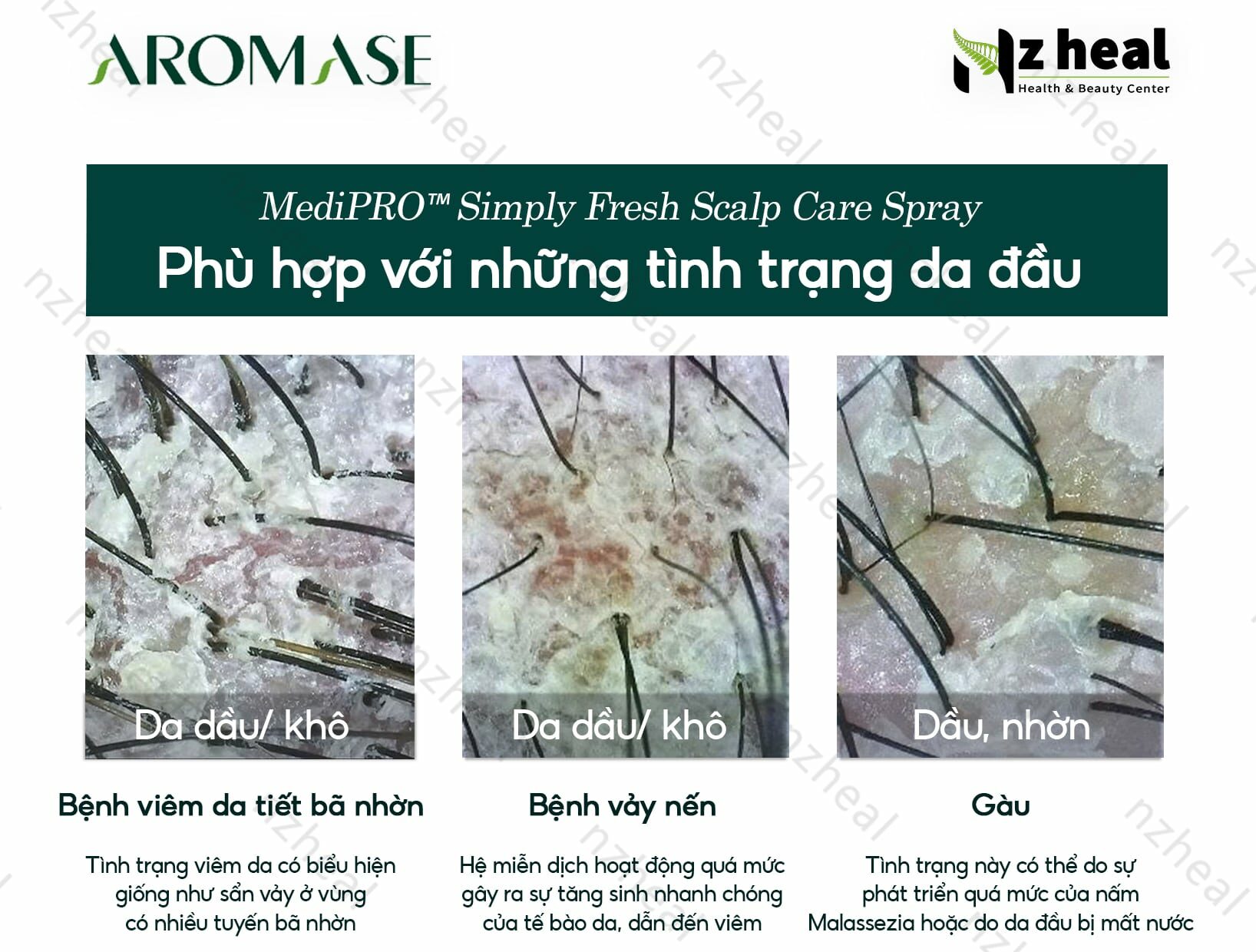 Xịt dưỡng và giảm viêm da đầu chuyên sâu Aromase 5α Juniper MediPRO Simply Fresh Spray 110ml 2-1