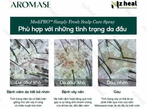 Xịt dưỡng và giảm viêm da đầu chuyên sâu Aromase 5α Juniper MediPRO Simply Fresh Spray 110ml 2-1