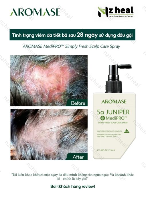 Xịt dưỡng và giảm viêm da đầu chuyên sâu Aromase 5α Juniper MediPRO Simply Fresh Spray 110ml 3-1
