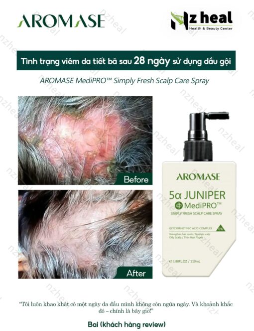 Xịt dưỡng và giảm viêm da đầu chuyên sâu Aromase 5α Juniper MediPRO Simply Fresh Spray 110ml 3-1