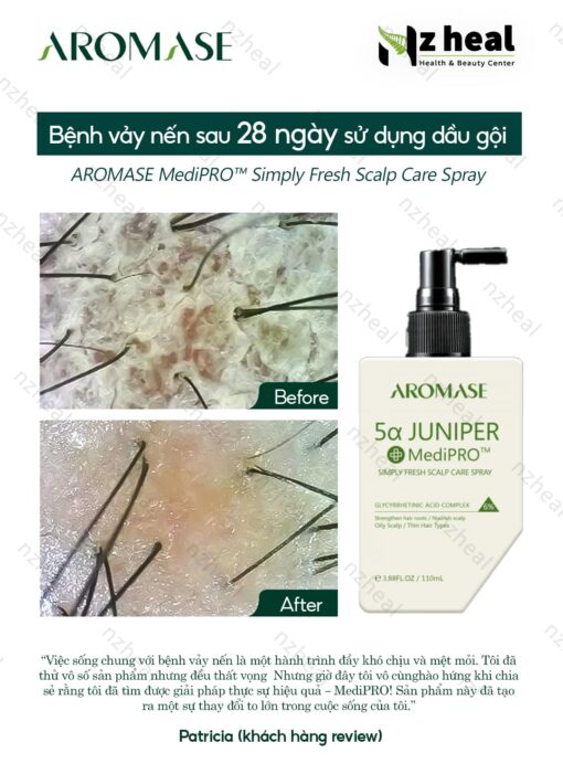 Xịt dưỡng và giảm viêm da đầu chuyên sâu Aromase 5α Juniper MediPRO Simply Fresh Spray 110ml 7