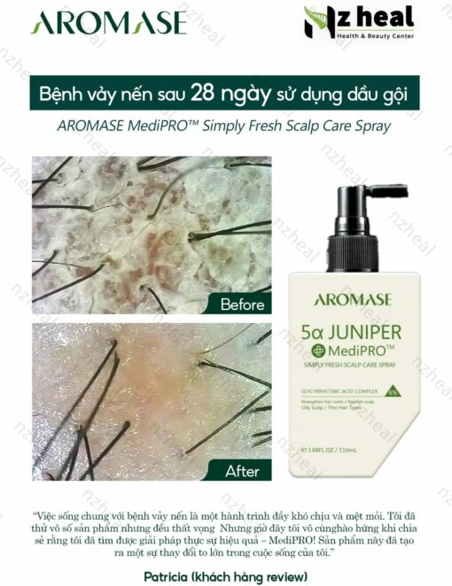 Xịt dưỡng và giảm viêm da đầu chuyên sâu Aromase 5α Juniper MediPRO Simply Fresh Spray 110ml 7