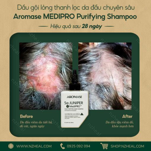 Bộ 3 Aromase Medipro trị viêm da đầu chuyên sâu: Tẩy tế bào chết + Dầu gội + Xịt dưỡng 3