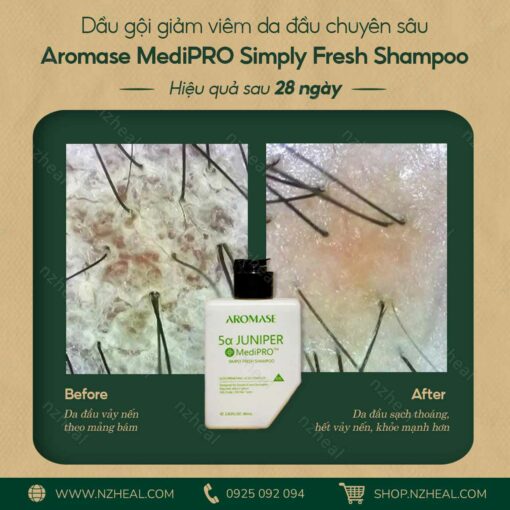 Bộ 3 Aromase Medipro trị viêm da đầu chuyên sâu: Tẩy tế bào chết + Dầu gội + Xịt dưỡng 4