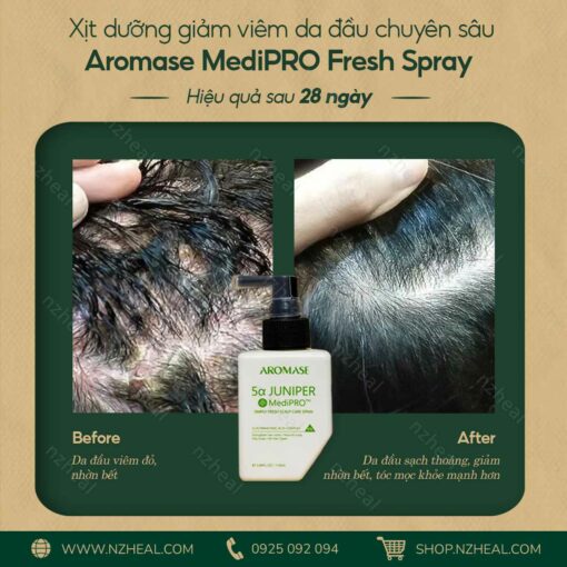 Bộ 3 Aromase Medipro trị viêm da đầu chuyên sâu: Tẩy tế bào chết + Dầu gội + Xịt dưỡng 6