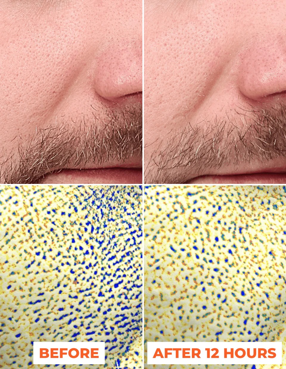 bo-doi-peel-da-sinh-hoc-2-buoc-dermeden-advanced-peel-pre-peel-truoc-thay-da-peel-thay-da3 Bộ đôi peel da sinh học 2 bước DermEden Advanced Peel: Pre-Peel (trước thay da) & Peel (thay da) 3