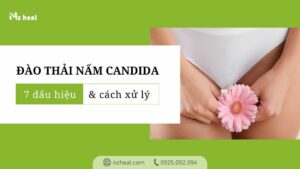 7 dấu hiệu của phản ứng đào thải nấm Candida và cách xử lý 1-1