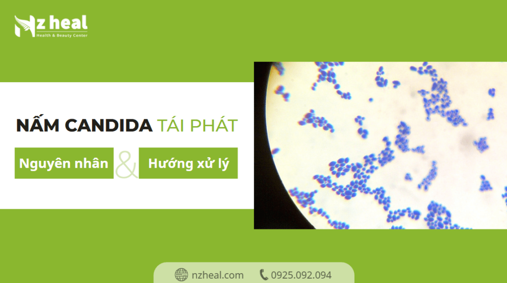 nam-candida-tai-phat-dai-dang-nguyen-nhan-va-huong-xu-ly-hieu-qua (1)