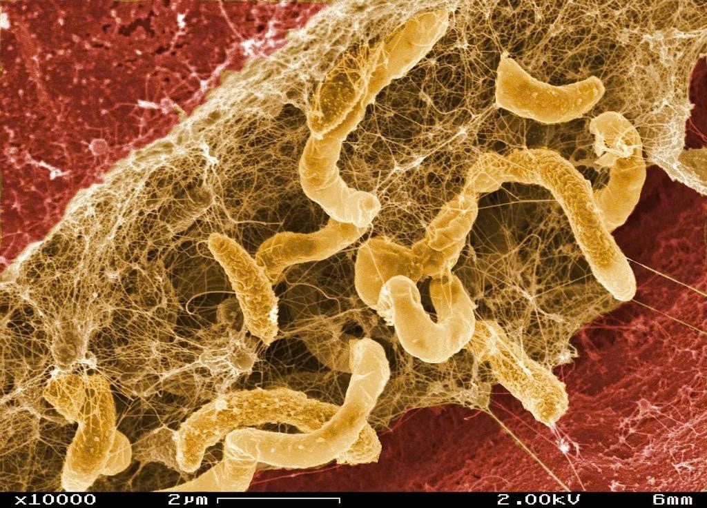 nam-candida-tai-phat-dai-dang-nguyen-nhan-va-huong-xu-ly-hieu-qua (1)